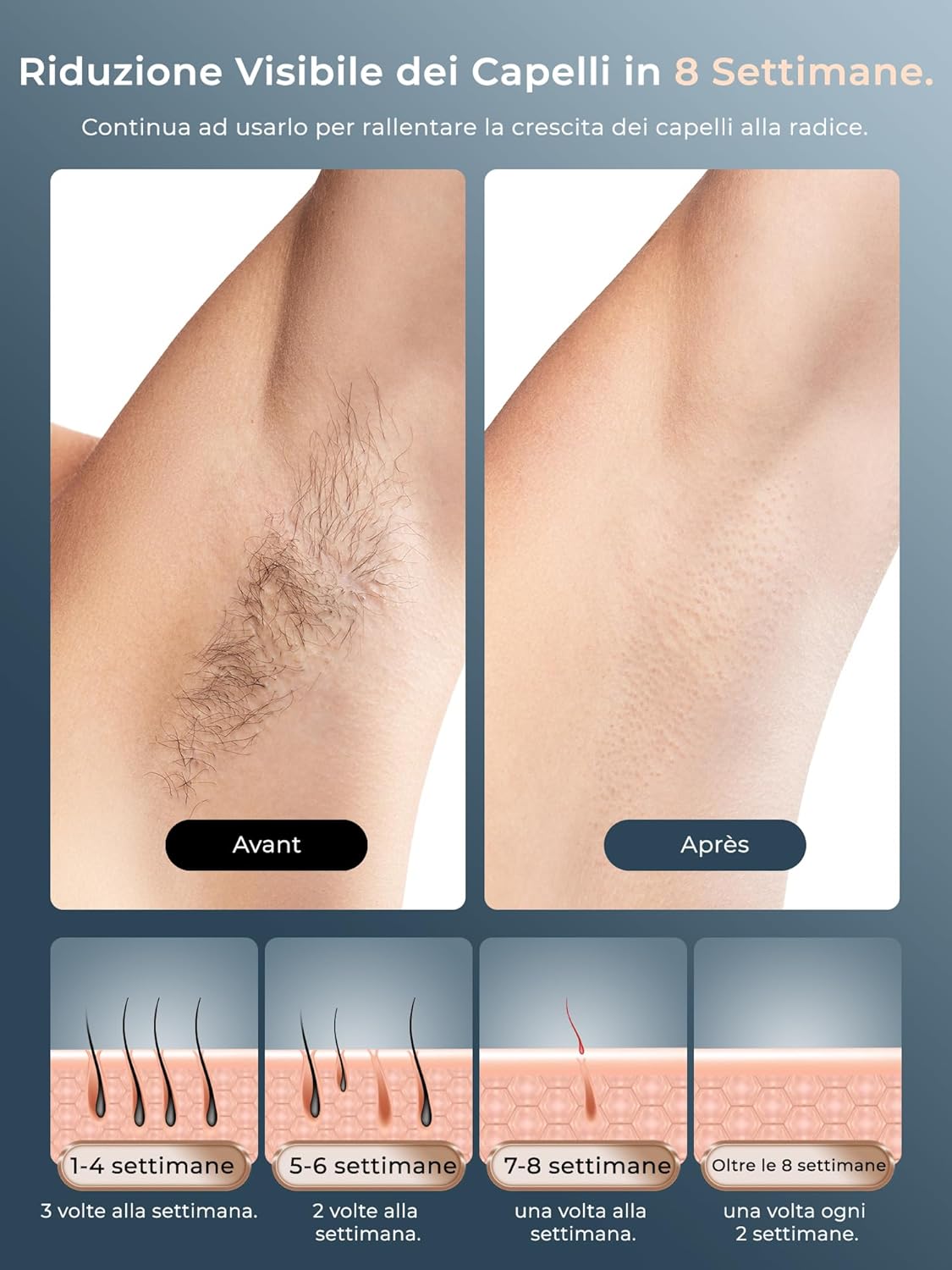 IPL hair removal device with ice-cooling function, LCD touchscreen